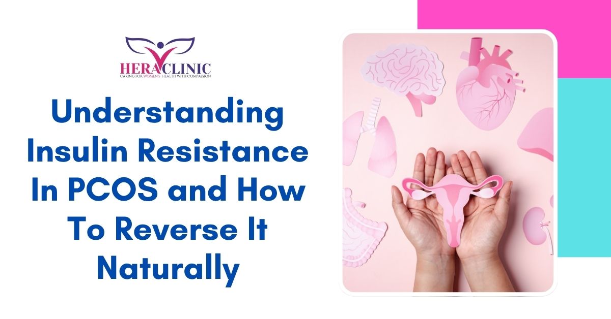 insulin-resistance-pcos-boost-metabolism