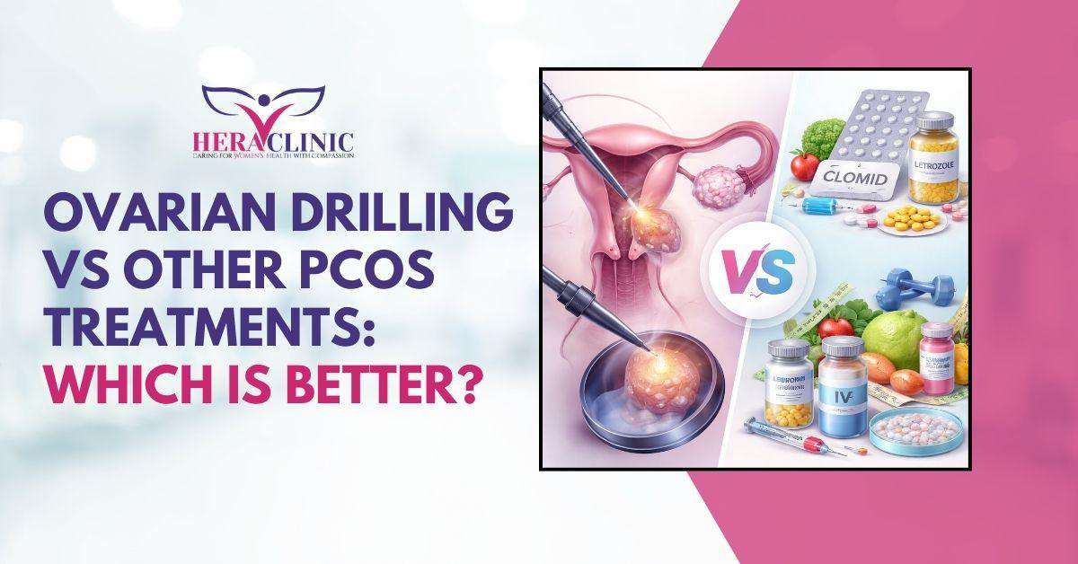 Ovarian Drilling vs Other PCOS Treatments
